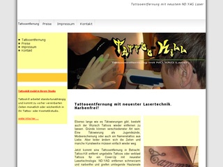 Tattooentfernung mit Laser